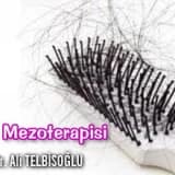 Saç Mezoterapisi