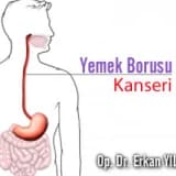 Yemek borusu kanseri hakkında merak edilenler