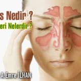 Sinüs nedir ? sinüslerin görevleri nelerdir ?