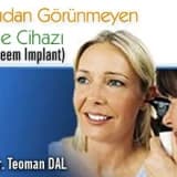 Dışarıdan görünmeyen işitme cihazı (esteem ımplant)