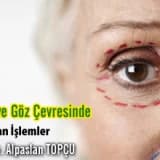 Kaş ve göz çevresinde yapılan işlemler