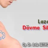 Lazerle dövme silme!