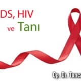 AIDS, HIV ve Tanı (p24, westernblot)