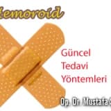 Hemoroid'te Güncel Tedavi Yöntemleri