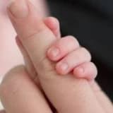 Doğumsal el anomalileri