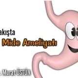 Bir bakışta tüp mide ameliyatı