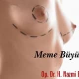 Meme büyütme !