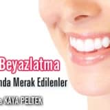 Diş Beyazlatma Hakkında Merak Edilenler