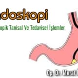 Endoskopi-endoskopik tanısal ve tedavisel işlemler