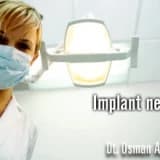 Implant hakkında merak ettikleriniz