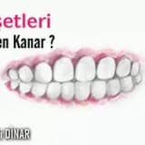 Dişetleri neden kanar?