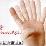 Baş Dönmesi (Vertigo)