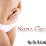 Karın Germe