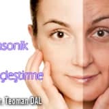 Ultrasonik yüz gençleştirme ( germe ) nedir?