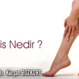 VARİS NEDİR?