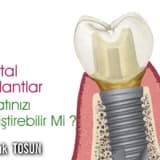 Dental implantlar hayatınızı  değiştirebilir mi?