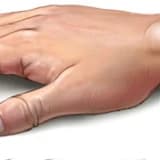 Ganglion nedir ?