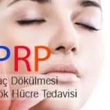 Saç dökülmesinde prp plazma tedavisi
