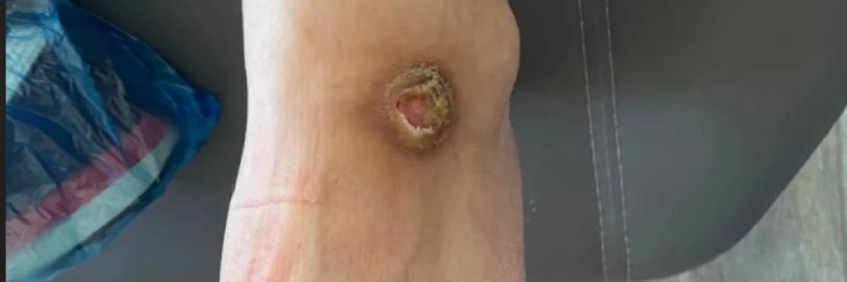 Mersinde; Geleneksel ve Tamamlayıcı Tıp, Akupunktur, ozon, biorezonans