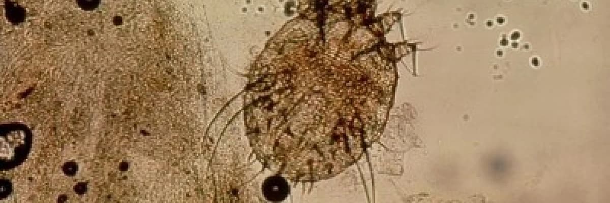 UYUZ: KABUS BİR KAŞINTI TABLOSU