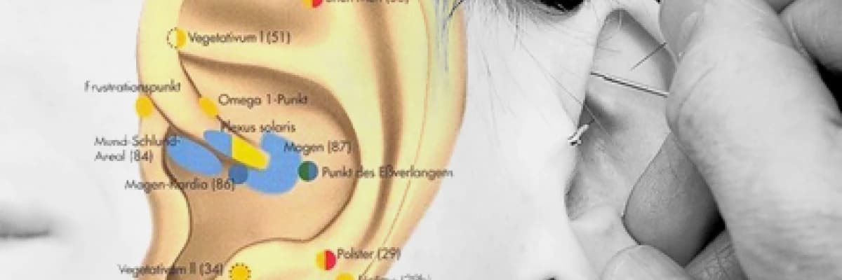 Akupunktur hakkında sık sorulan sorular