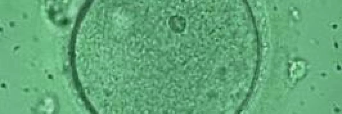 Yardımcı Üreme Teknikleri!