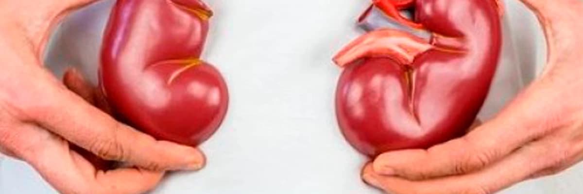 Çocukluk çağı böbrek taşı hastalığı