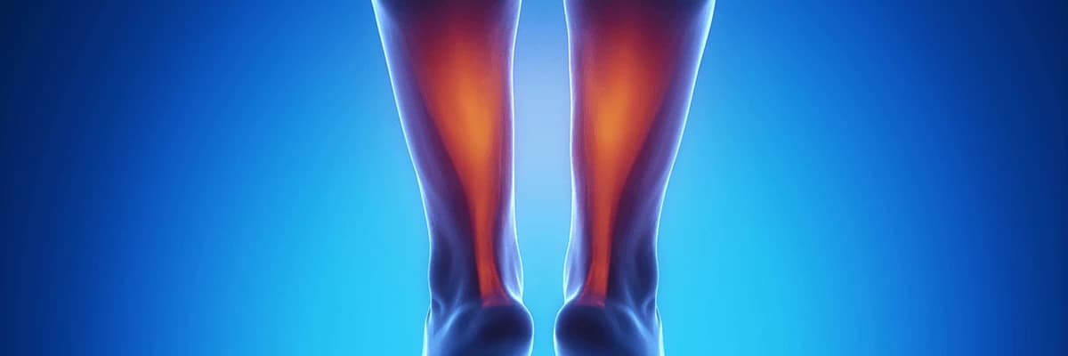 AŞİL TENDİNİTİ NEDİR?