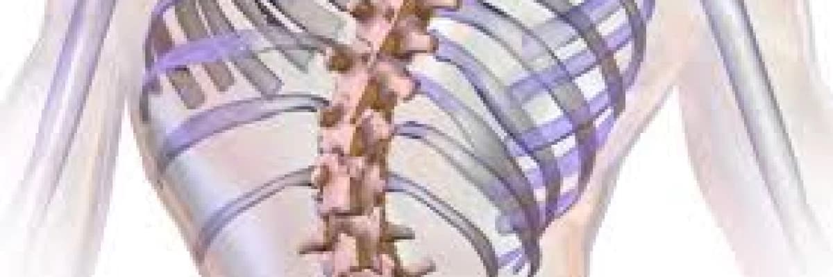 SKOLYOZ NEDİR VE TEDAVİSİ NASIL PLANLANIR?