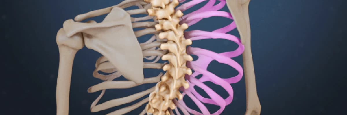 skolyozda fizik tedavi yöntemleri