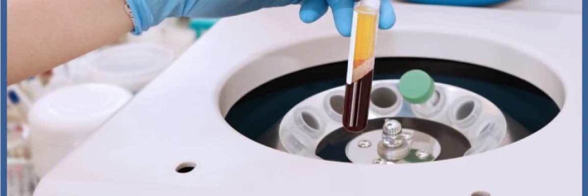 PRP'nin yumurtalıklar üzerindeki etkisi