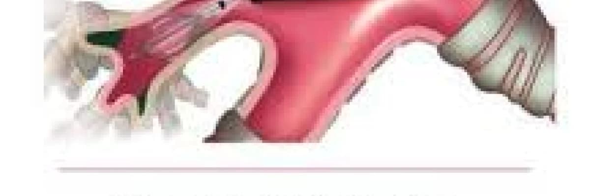 KOAH BALON TEDAVİSİ VE YARARLARI