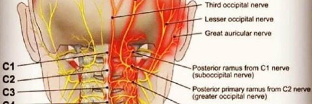 Özel Bir Baş Ağrısı Tipi: Oksipital Nevralji
