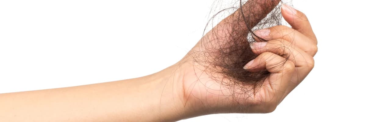 Saç Dökülmesi (Alopesi)