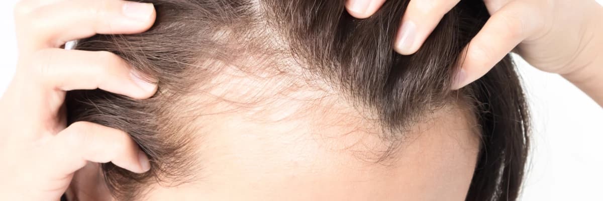 PRP (trombositten zengin plazma)