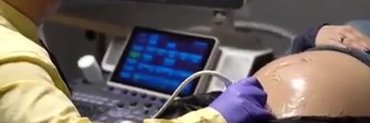 Detaylı Ultrason Hakkında Merak Edilenler