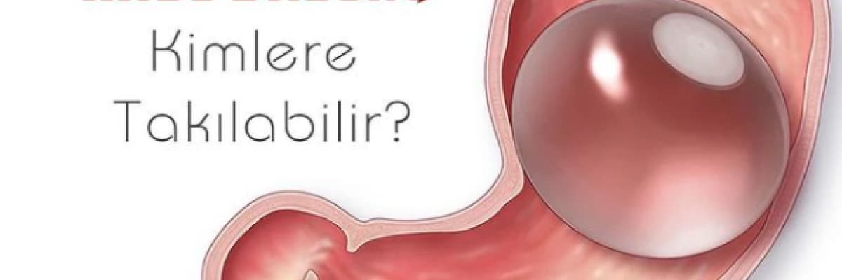 Mide Balonu Kimlere Takılabilir?