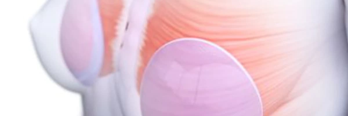 Kanserli Memeye Silikon Tedavisi