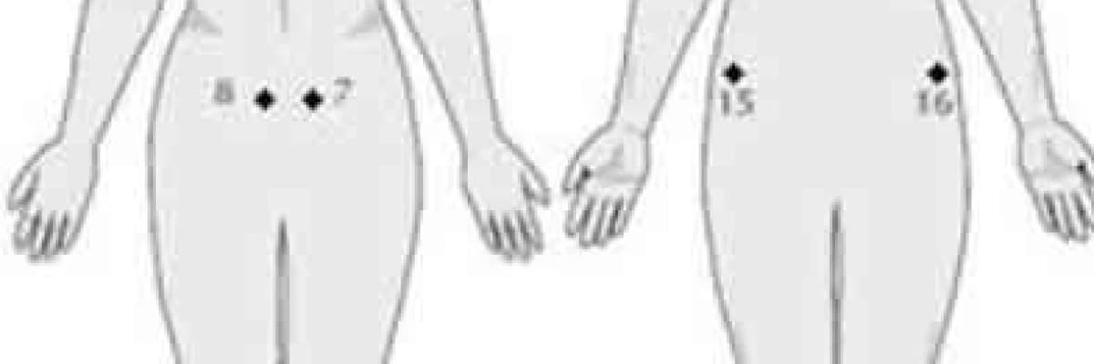 Fibromiyalji: Nedir? Tedavi de Kullanılan Yöntemler Nelerdir?