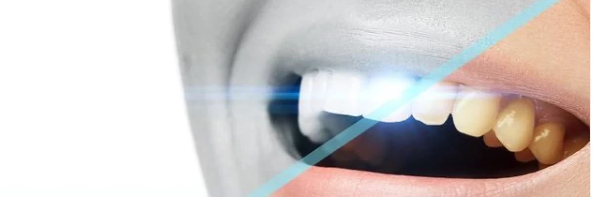 Dişler Neden Sararır?