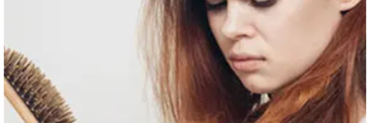 Kadın Tipi Saç Dökülmesi