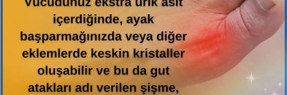 Gut (Damla Hastalığı)