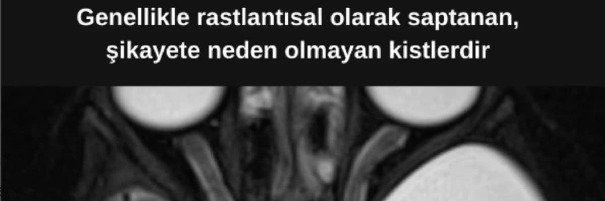 ARAKNOİD KİST