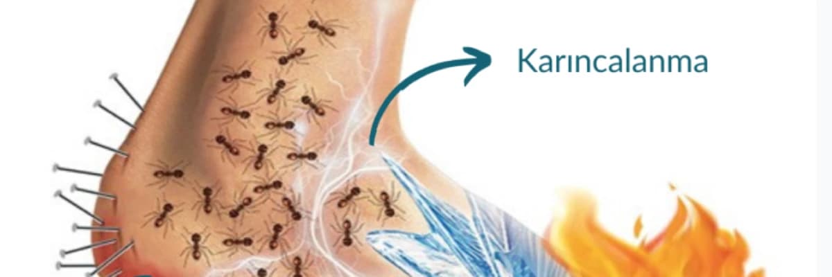 Diyabetik Ayak Sendromu Semptomları