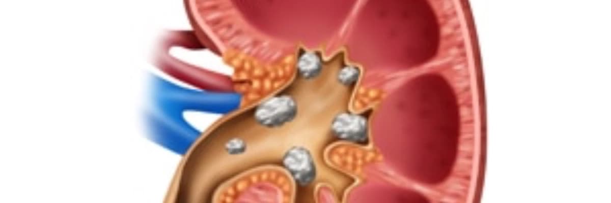 Böbrek Taşı Tekrarlar mı?