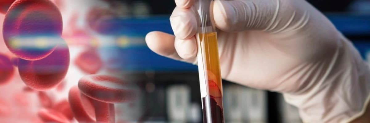 Platelet Rich Plasma - PRP