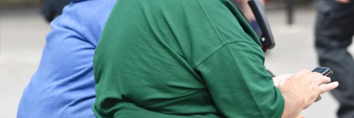 Son Dönemlerde Oldukça Popüler Olan Şişmanlık (Obezite) Cerrahisi Kimlere Yapılır?