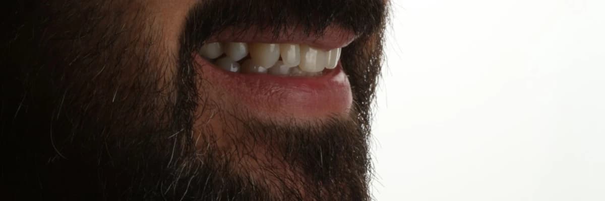 Ortodontik tedavi sırasında nelere dikkat edilmesi gerekir ?