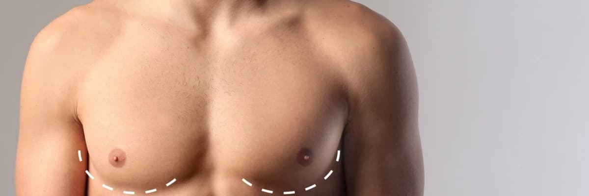 Jinekomasti Nedir? Nasıl Yapılır?