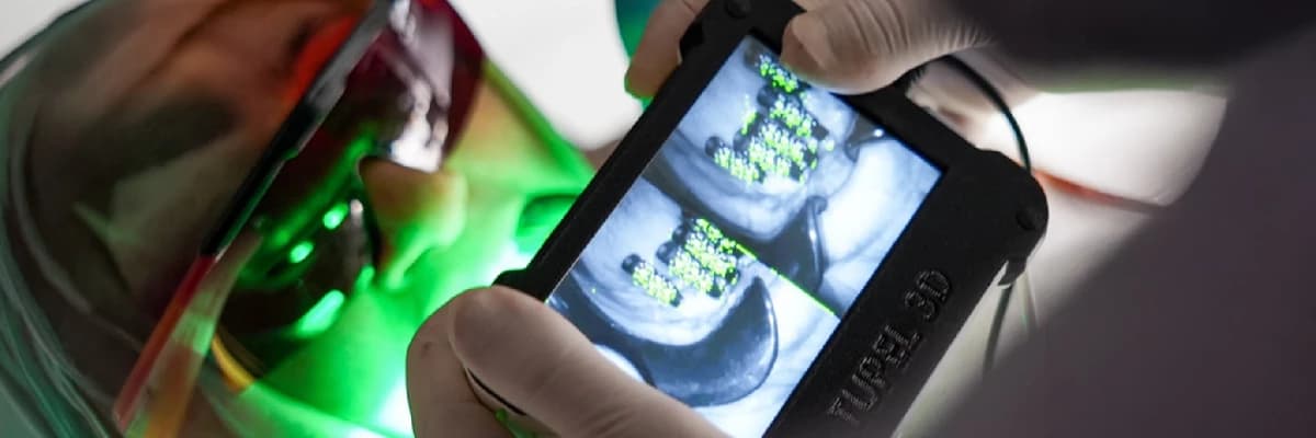 3D Tüpel Cihazı Nedir? Dijital Diş Hekimliğinde Ölçü Alma Teknolojisi